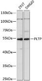 Anti-PLTP antibody used in Western Blot (WB). GTX33416
