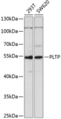 Anti-PLTP antibody used in Western Blot (WB). GTX33416