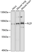 Anti-PLZF antibody used in Western Blot (WB). GTX33417