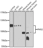 Anti-PMS2 antibody used in Western Blot (WB). GTX33418