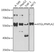 Anti-ATGL antibody used in Western Blot (WB). GTX33419