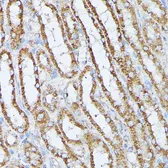 Anti-PP2A beta antibody used in IHC (Paraffin sections) (IHC-P). GTX33421