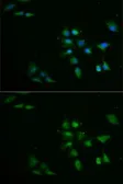 Anti-PPOX antibody used in Immunocytochemistry/ Immunofluorescence (ICC/IF). GTX33424
