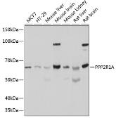Anti-PPP2R1A antibody used in Western Blot (WB). GTX33425