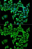 Anti-PPP2R1A antibody used in Immunocytochemistry/ Immunofluorescence (ICC/IF). GTX33425