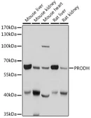 Anti-PRODH antibody used in Western Blot (WB). GTX33428