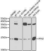 Anti-Profilin 2 antibody used in Western Blot (WB). GTX33429