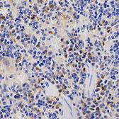 Anti-Proteasome 26S S3 antibody used in IHC (Paraffin sections) (IHC-P). GTX33430