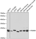 Anti-Proteasome beta 4 antibody used in Western Blot (WB). GTX33431