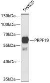 Anti-PRP19 antibody used in Western Blot (WB). GTX33432