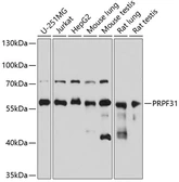 Anti-PRPF31 antibody used in Western Blot (WB). GTX33433