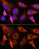 Anti-PSAT1 antibody used in Immunocytochemistry/ Immunofluorescence (ICC/IF). GTX33434