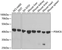 Anti-PSMC6 antibody used in Western Blot (WB). GTX33436
