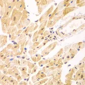 Anti-PSMD2 antibody used in IHC (Paraffin sections) (IHC-P). GTX33439