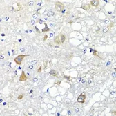 Anti-PSPH antibody used in IHC (Paraffin sections) (IHC-P). GTX33442