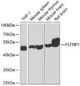 Anti-PSTPIP1 antibody used in Western Blot (WB). GTX33443