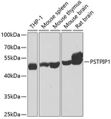 Anti-PSTPIP1 antibody used in Western Blot (WB). GTX33443