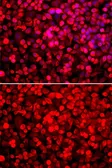 Anti-PUF60 antibody used in Immunocytochemistry/ Immunofluorescence (ICC/IF). GTX33446
