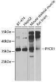 Anti-PYCR1 antibody used in Western Blot (WB). GTX33447