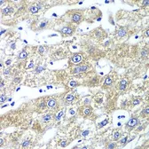 Anti-QARS antibody used in IHC (Paraffin sections) (IHC-P). GTX33449