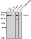Anti-RAD23A antibody used in Western Blot (WB). GTX33455