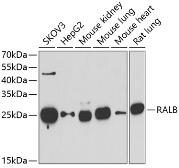 Anti-RALB antibody used in Western Blot (WB). GTX33457