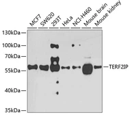 Anti-RAP1 antibody used in Western Blot (WB). GTX33458