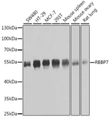 Anti-RbAp46 antibody used in Western Blot (WB). GTX33460