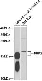 Anti-RBP2 antibody used in Western Blot (WB). GTX33462
