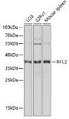 Anti-RFC2 antibody used in Western Blot (WB). GTX33463