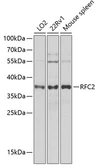 Anti-RFC2 antibody used in Western Blot (WB). GTX33463