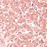 Anti-RNF5 antibody used in IHC (Paraffin sections) (IHC-P). GTX33468