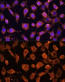 Anti-RPL11 antibody used in Immunocytochemistry/ Immunofluorescence (ICC/IF). GTX33471