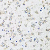 Anti-RPLP1 antibody used in IHC (Paraffin sections) (IHC-P). GTX33474