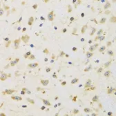 Anti-RPS12 antibody used in IHC (Paraffin sections) (IHC-P). GTX33476