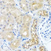 Anti-RPS2 antibody used in IHC (Paraffin sections) (IHC-P). GTX33477