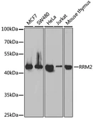 Anti-RRM2 antibody used in Western Blot (WB). GTX33480