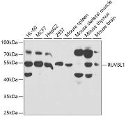 Anti-RUVBL1 antibody used in Western Blot (WB). GTX33482