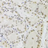 Anti-RUVBL1 antibody used in IHC (Paraffin sections) (IHC-P). GTX33482