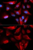Anti-S100A11 antibody used in Immunocytochemistry/ Immunofluorescence (ICC/IF). GTX33483