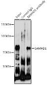Anti-SAMHD1 antibody used in Immunoprecipitation (IP). GTX33484
