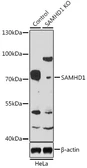 Anti-SAMHD1 antibody used in Western Blot (WB). GTX33484