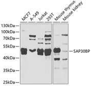 Anti-SAP30BP antibody used in Western Blot (WB). GTX33485