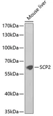 Anti-SCP2 antibody used in Western Blot (WB). GTX33487