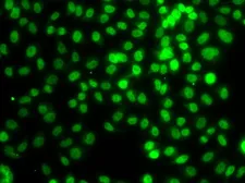 Anti-SETD8 antibody used in Immunocytochemistry/ Immunofluorescence (ICC/IF). GTX33491
