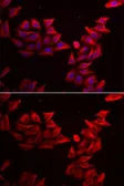 Anti-SFRP4 antibody used in Immunocytochemistry/ Immunofluorescence (ICC/IF). GTX33493