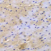 Anti-SGCE antibody used in IHC (Paraffin sections) (IHC-P). GTX33494
