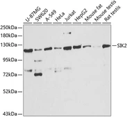 Anti-SIK2 antibody used in Western Blot (WB). GTX33497