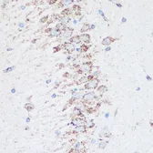 Anti-SIRT4 antibody used in IHC (Paraffin sections) (IHC-P). GTX33501
