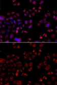 Anti-SLC22A11 antibody used in Immunocytochemistry/ Immunofluorescence (ICC/IF). GTX33503